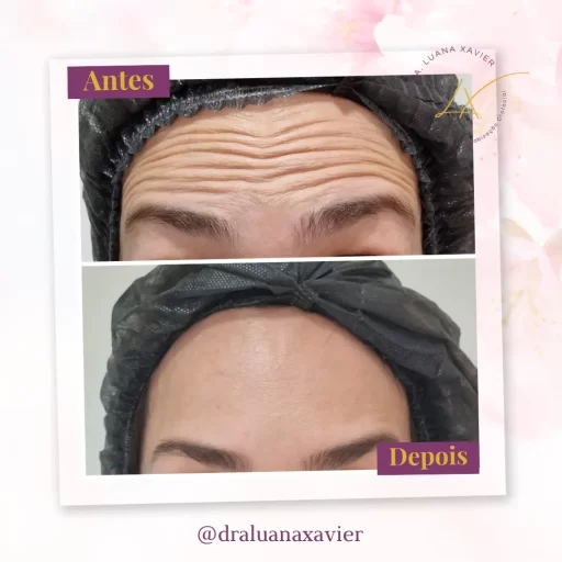Dra Luana Xavier Antes e Depois (15) copy